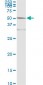 ACY1 Antibody (monoclonal) (M01)